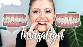 I GOT INVISALIGN  IN DEPTH All About My Teeth  1 Week Review  TIPS [upl. by Kohler]