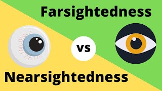 Difference between Myopia  Near Sightedness and Hyperopia  FarSightedness [upl. by Phylis]