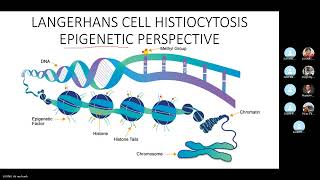 JCS 7 Langerhans cell histiocytosis [upl. by Sybley]