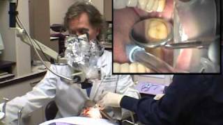 Dr David Clark Modern Version of Sealants Part 1 [upl. by Alinna]