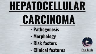 Hepatocellular Carcinoma  HCC   Pathophysiology  Morphology  Clinical features [upl. by Eizus]