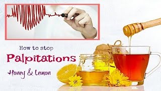 How to Stop Heart Palpitations  Home Remedies for Palpitations [upl. by Adon]