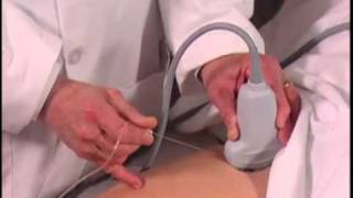 How To Ultrasound Guided Hip Injection Scanning Technique Video [upl. by Torrance428]