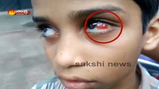 Sri Chaitanya Hostel Warden Brutally Beats 8th Student in Hayathnagar  Hyderabad [upl. by Rhine]