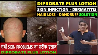 Diprobate Plus Lotion To Treat Dermatitis Dandruff amp All Skin Problems  Improve Hair Growth [upl. by Zelda]