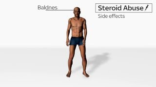 Side Effects of Steroids Abuse [upl. by Centonze]