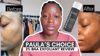 Paula’s Choice BHA 2 Liquid Exfoliant Review Skincare review [upl. by Edahsalof707]