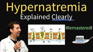 Hypernatremia Explained Types Diagnosis amp Treatment [upl. by Ellinet138]