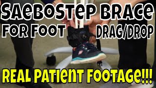 SaeboStep Brace for Foot DragDrop  REAL Patient Footage [upl. by Cavan]