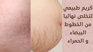 كريم طبيعي لعلاج علامات تمدد الجسم الخطوط الحمراء و البيضاء [upl. by Greggs]