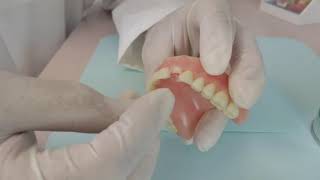 How to repair broken dentures [upl. by Nothsa116]