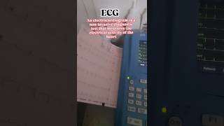 📈ecg heart beats cardiac function signal ytshorts video short [upl. by O'Neil670]