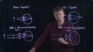 Near Sighted vs Far Sighted  Physics with Professor Matt Anderson  M2802 [upl. by Grazia]