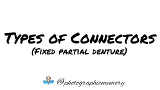 Types of connectors  Fixed partial denture [upl. by Novets]