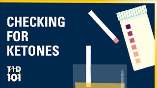 UM Type 1 Diabetes 101  Module 2  Checking for Ketones [upl. by Carmel]