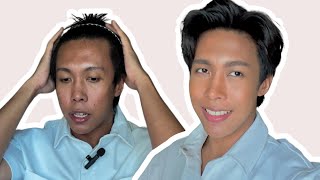 How to cover acne scars makeup tutorial for acne prone skin with craters amp dark pigmentation [upl. by Eissirk]