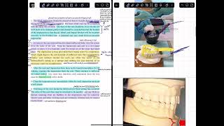 شرح prosthodontics lec 6step by step procedure for making a stone cast طب اسنان مرحلة رابعه [upl. by Aneloaup]