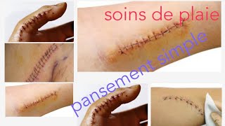 Soins infirmiers en chirurgie soins des plaies  pansement simple [upl. by Oranneg373]