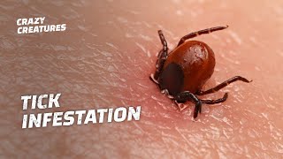 WARNING The Most Horrific Tick Infestations [upl. by Eceirtal]