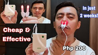 BIONASE RHINITIS SINUSITIS NOSE THERAPY LED LIGHT  ANG CHEAP  EFFECTIVE BA NURSE REAL TALK REVIEW [upl. by Larred]