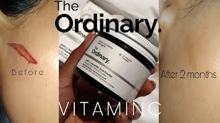 THE ORDINARY 100 LASCORBIC ACID POWDER REVIEW AND HOW TO USE IT [upl. by Adlai]