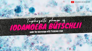 Trophozoite phase of Iodamoeba bütschlii under the microscope with Trichrome stain [upl. by Harriman]