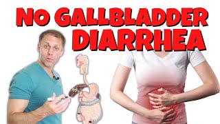 Diarrhea or Loose Stools After Gallbladder Removal [upl. by Blane]