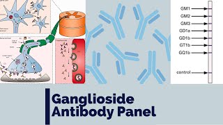 Ganglioside antibody panel  Anti GM1  Immune mediated neuropathy  MMN  MADSAM  CIDP  GBS [upl. by Llywellyn723]