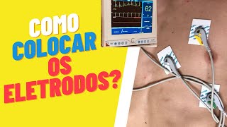 Como Colocar os Eletrodos de ECG eletrocardiograma enfermagem nasctreinamentosenfermagem [upl. by Alithia71]