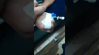 Iv cannulation insertion technique 👍 [upl. by Roman938]