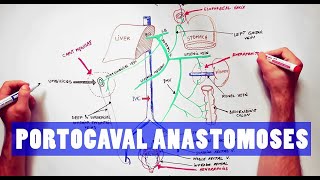 Portocaval Anastomoses  ANATOMY Tutorial [upl. by Kiefer]