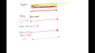 Nephrology 14b recap of nephroticnephritic spectrum SLE PSGN IgA vasculitis amyloidosis DM [upl. by Melia722]