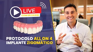 Implantes Zigomáticos e All on 4  Live Protocolo Implace [upl. by Cele]