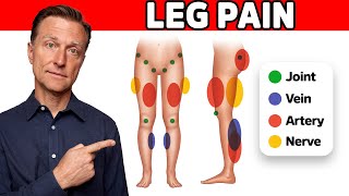 The 11 Causes of Leg Pain Revealed [upl. by Heti]