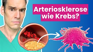 Arteriosklerose  eine tumorartige Erkrankung  Dr Waller erklärt [upl. by Semmes401]