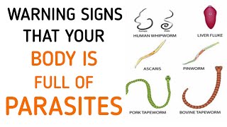 Dont Ignore These Early Symptoms Of Parasites In Your Body [upl. by Madra]