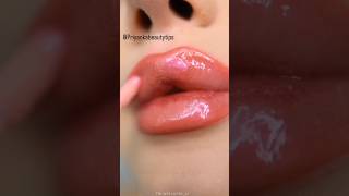 Transform Your Lips 100 Effective Dark Lip Pigmentation Treatment at Home skincare [upl. by Stoat]