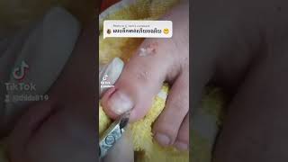 How to use a cuticle nipper nail​​​ nailart fyp ear shorts viral wax blackheads [upl. by Aihcela]