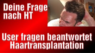 Minoxidil Erfahrung Haartransplantation Haarausfall Hausmittel Medical Exclusive Türkei Erfahrung [upl. by Ailama490]