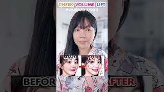 ONLY 2 EXERCISE PLUMP CHEEK VOLUME LIFT  Get Apple cheeks Chubby Cheeks Fuller cheeks [upl. by Aletha]