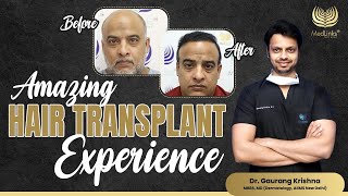 Amazing Hair Transplant Journey  Best Hair Transplant Result  MedLinks [upl. by Sadnalor]