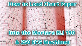 How to Load Chart Paper in the Mortara ELI 150 amp 250 ECG Machines [upl. by Simmie]