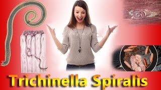 Trichinell Spiralis Complete Overview [upl. by Vassili34]