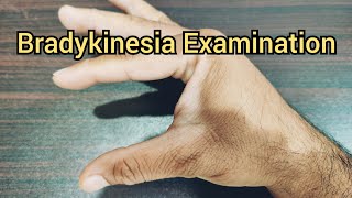 How to Examine a Patient for Bradykinesia  Parkinsonism [upl. by Ettessil767]