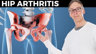 How Bob Relieves His Hip Arthritis In 10 Minutes [upl. by Kraus654]