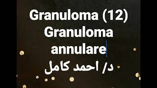 12 Granuloma annulare [upl. by Fay956]