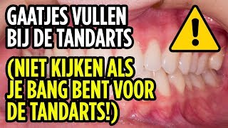 Gaatjes Vullen Bij De Tandarts  Filling Cavities At The Dentist ENG SUBS [upl. by Lotsyrk]