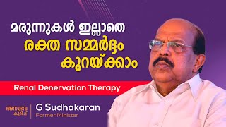 Renal Denervation Therapy for Hypertension  RDN  G Sudhakaran  Parumala Cardiology [upl. by Nospmis404]