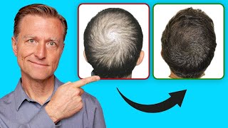 How to Help Regrow Your Hair UPDATED VITAL INFO [upl. by Aisenat]