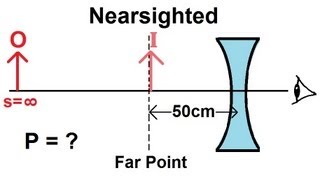 Physics  Optics Vision Correction 2 of 5 Nearsighted [upl. by Anihsat]